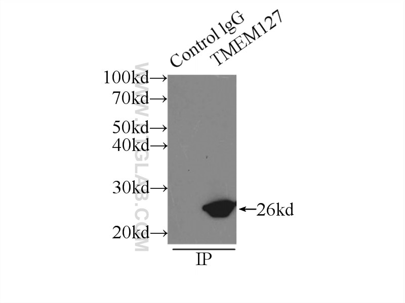 Immunoprecipitation (IP) experiment of HeLa cells using TMEM127 Polyclonal antibody (23142-1-AP)