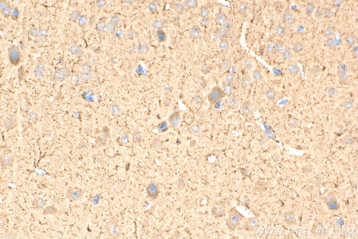 Immunohistochemistry (IHC) staining of mouse brain tissue using TMEM132A Polyclonal antibody (25301-1-AP)