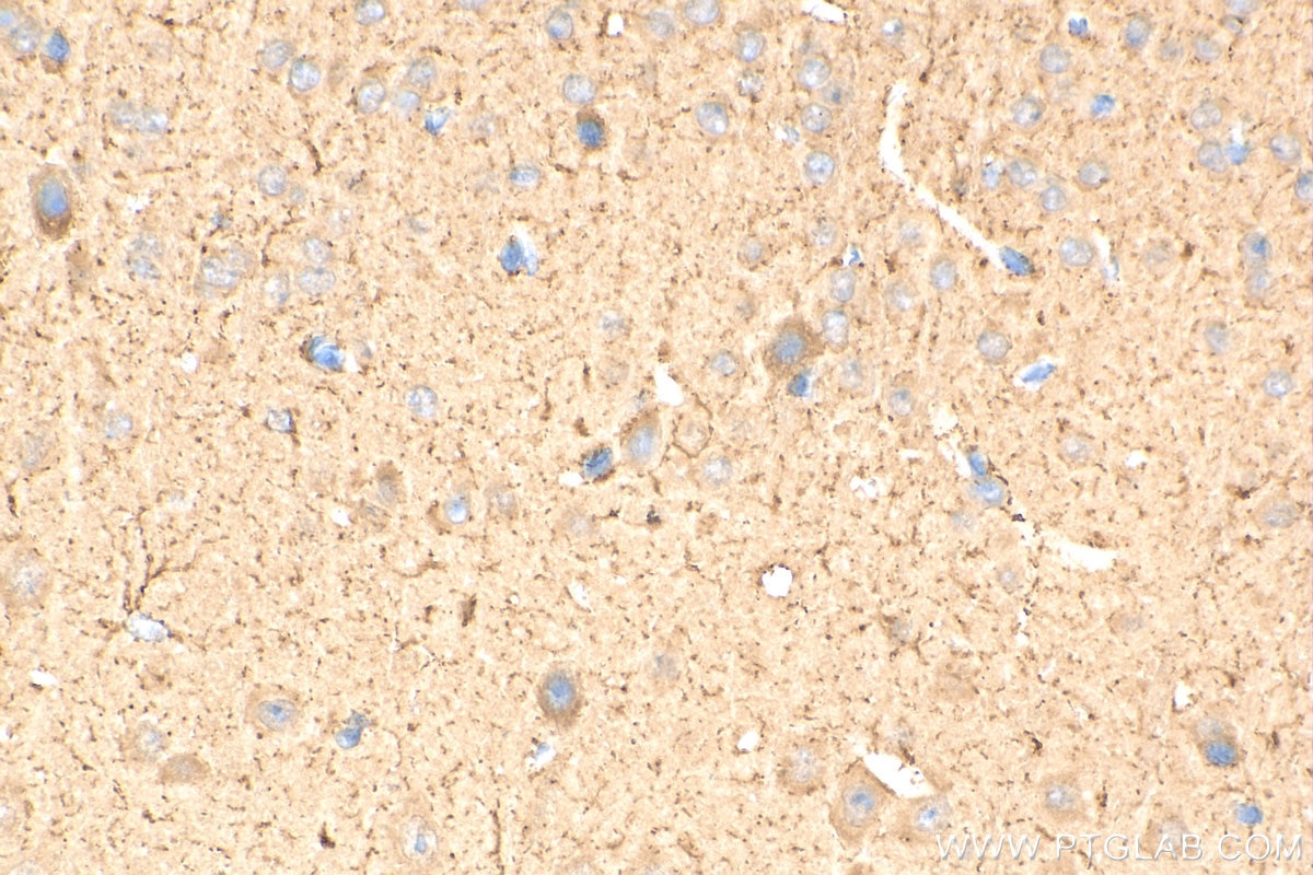 Immunohistochemistry (IHC) staining of mouse brain tissue using TMEM132A Polyclonal antibody (25301-1-AP)