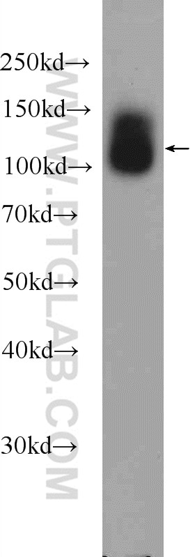 Western Blot (WB) analysis of fetal human brain tissue using TMEM132A Polyclonal antibody (25301-1-AP)