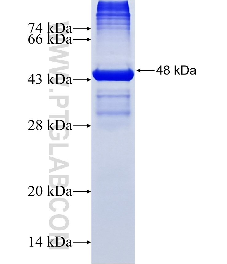 TMEM132D fusion protein Ag18405 SDS-PAGE