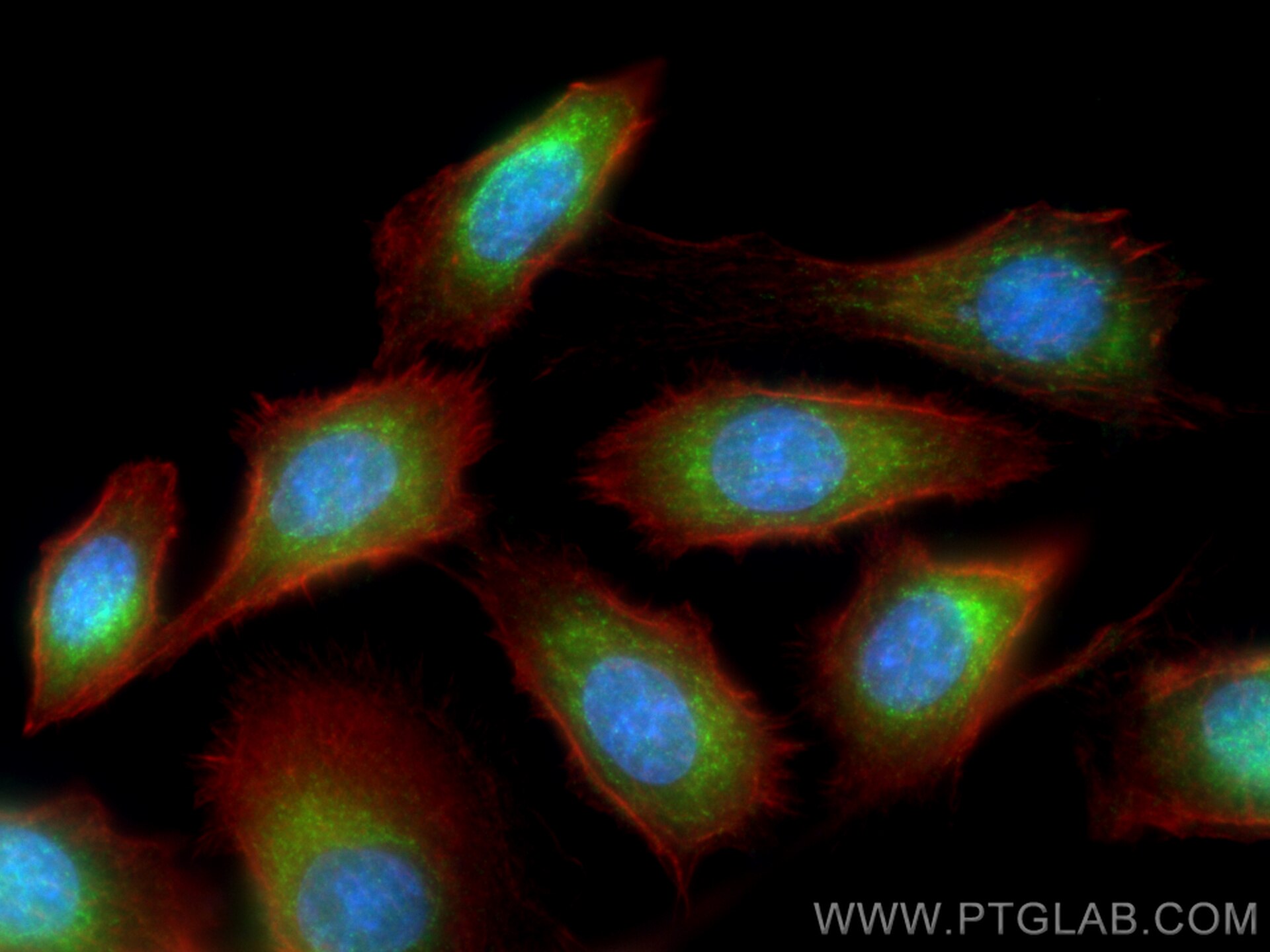 Immunofluorescence (IF) / fluorescent staining of PC-3 cells using TMEM134 Polyclonal antibody (25078-1-AP)