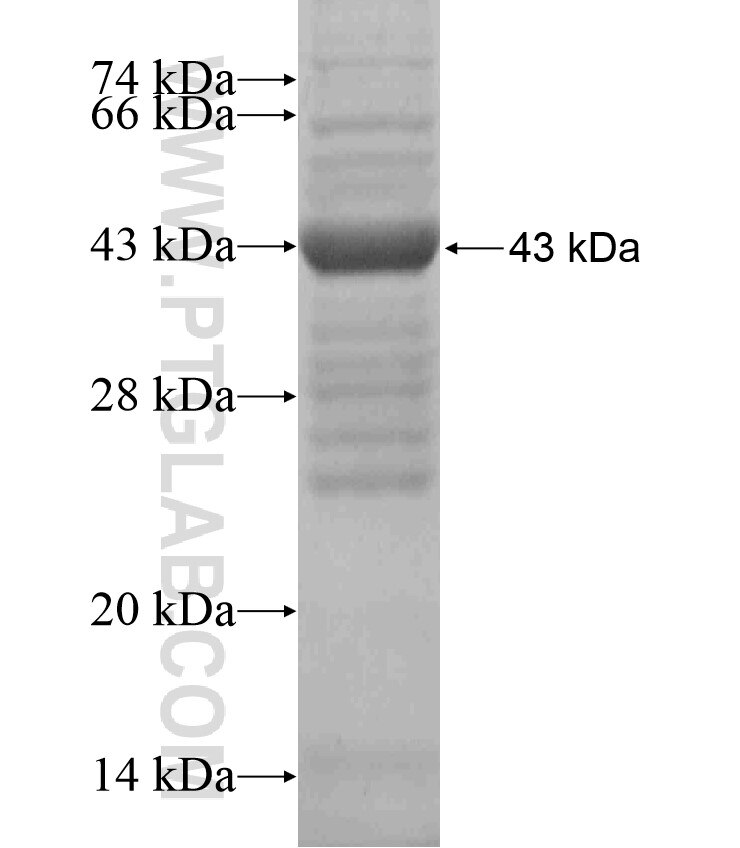 TMEM134 fusion protein Ag18533 SDS-PAGE