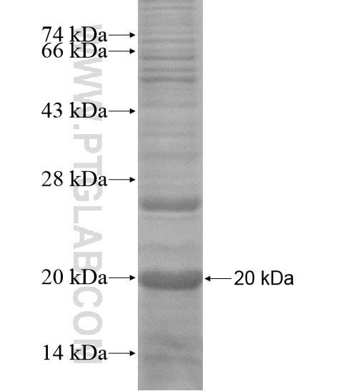 TMEM134 fusion protein Ag18637 SDS-PAGE