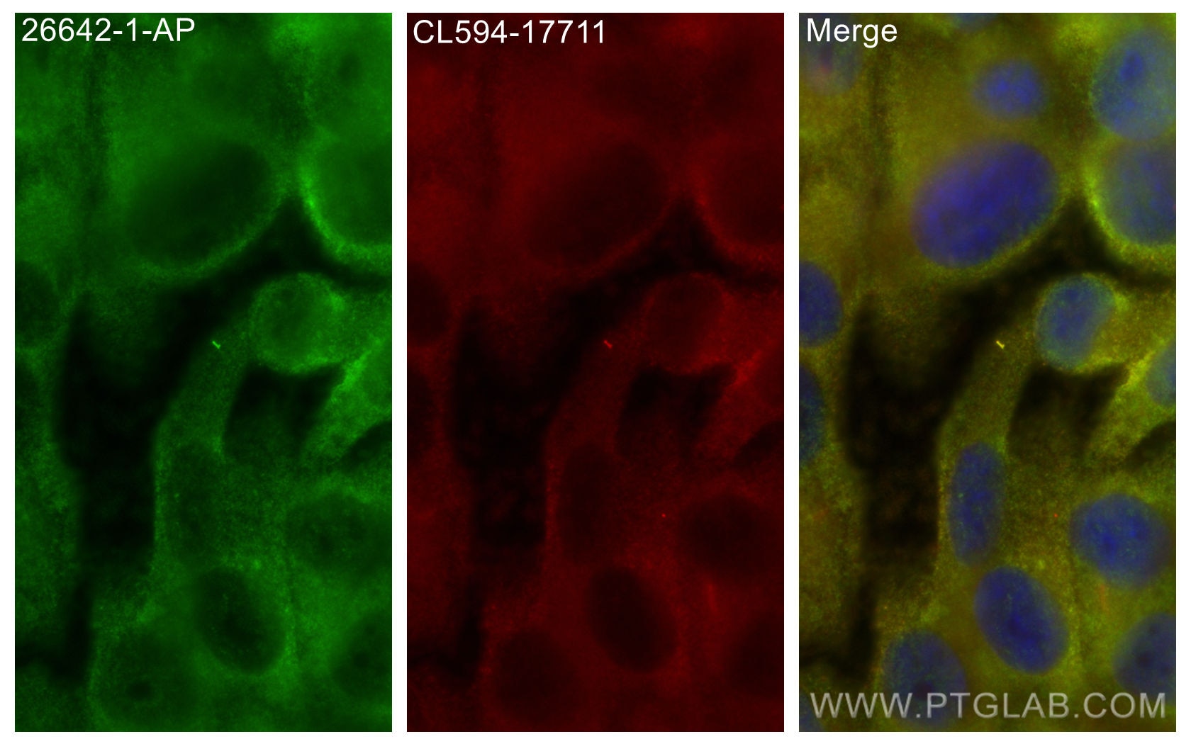 Immunofluorescence (IF) / fluorescent staining of hTERT-RPE1 cells using TMEM138 Polyclonal antibody (26642-1-AP)