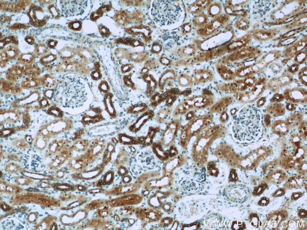 Immunohistochemistry (IHC) staining of human kidney tissue using TMEM139 Polyclonal antibody (21912-1-AP)