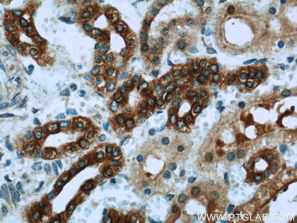 Immunohistochemistry (IHC) staining of human kidney tissue using TMEM139 Polyclonal antibody (21912-1-AP)