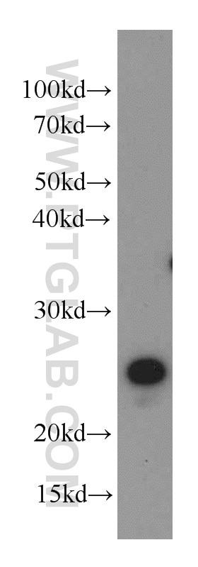 Western Blot (WB) analysis of mouse lung tissue using TMEM139 Polyclonal antibody (21912-1-AP)