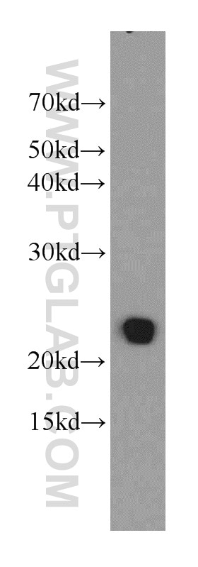 Western Blot (WB) analysis of mouse lung tissue using TMEM139 Polyclonal antibody (21912-1-AP)