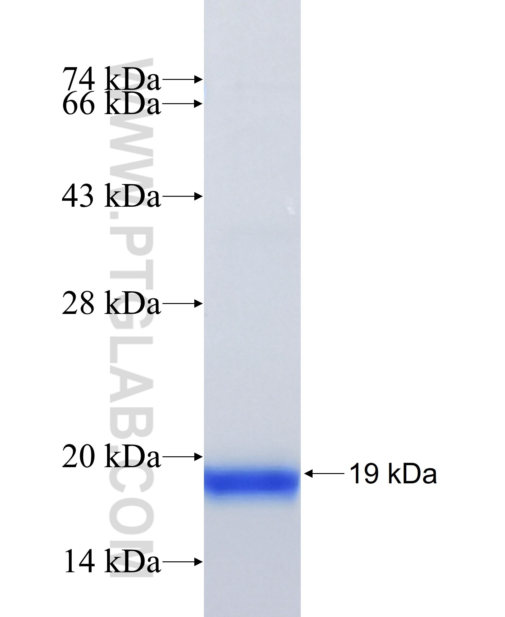 TMEM140 fusion protein Ag41331 SDS-PAGE TMEM140 fusion protein Ag41331 SDS-PAGE