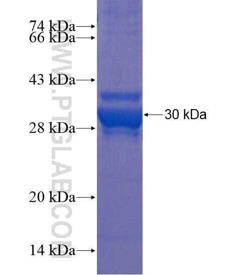 TMEM140 fusion protein Ag20428 SDS-PAGE