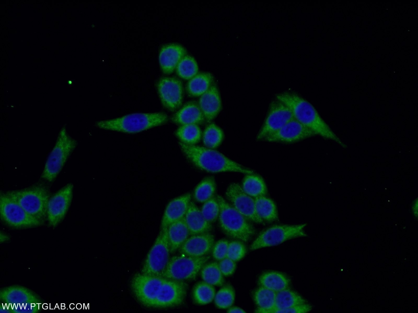 Immunofluorescence (IF) / fluorescent staining of HeLa cells using TMEM141 Polyclonal antibody (16092-1-AP)