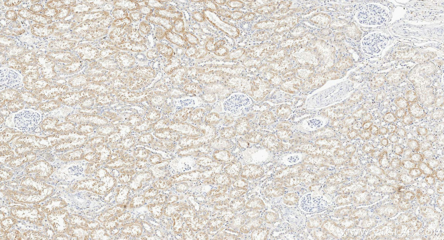 IHC staining of human kidney using 16092-1-AP Immunohistochemistry (IHC) staining of human kidney tissue using TMEM141 Polyclonal antibody (16092-1-AP)