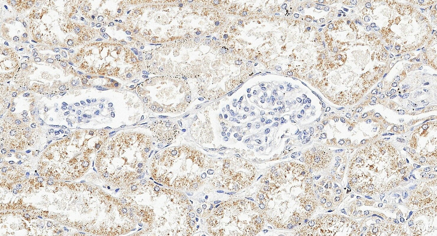 IHC staining of human kidney using 16092-1-AP Immunohistochemistry (IHC) staining of human kidney tissue using TMEM141 Polyclonal antibody (16092-1-AP)