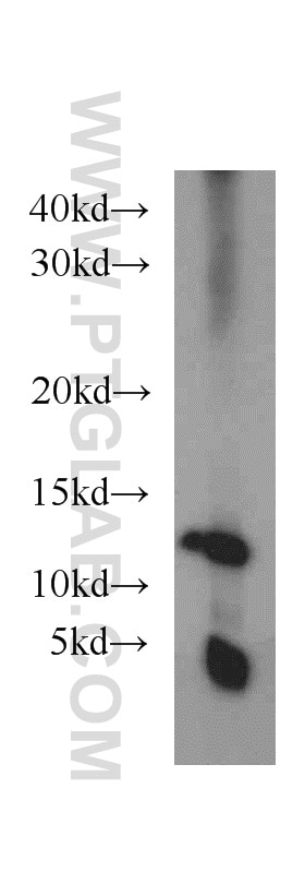 Western Blot (WB) analysis of MCF-7 cells using TMEM141 Polyclonal antibody (16092-1-AP)