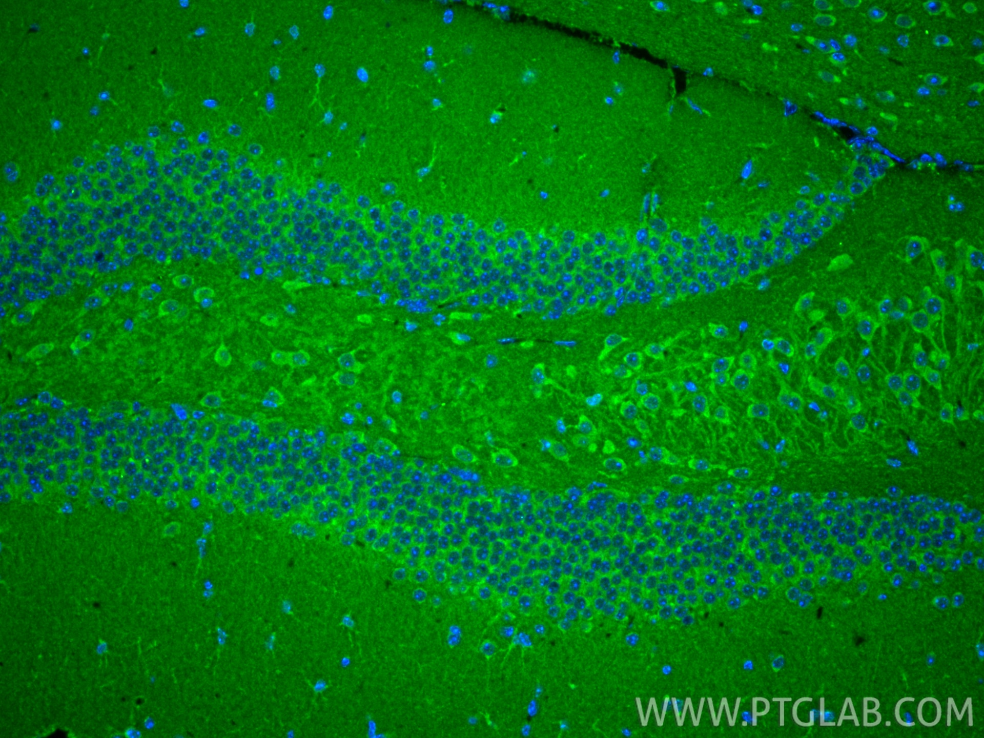 IF Staining of mouse brain using 31917-1-AP (same clone as 31917-1-PBS) Immunofluorescence (IF) / fluorescent staining of mouse brain tissue using TMEM143 Polyclonal antibody (31917-1-AP)