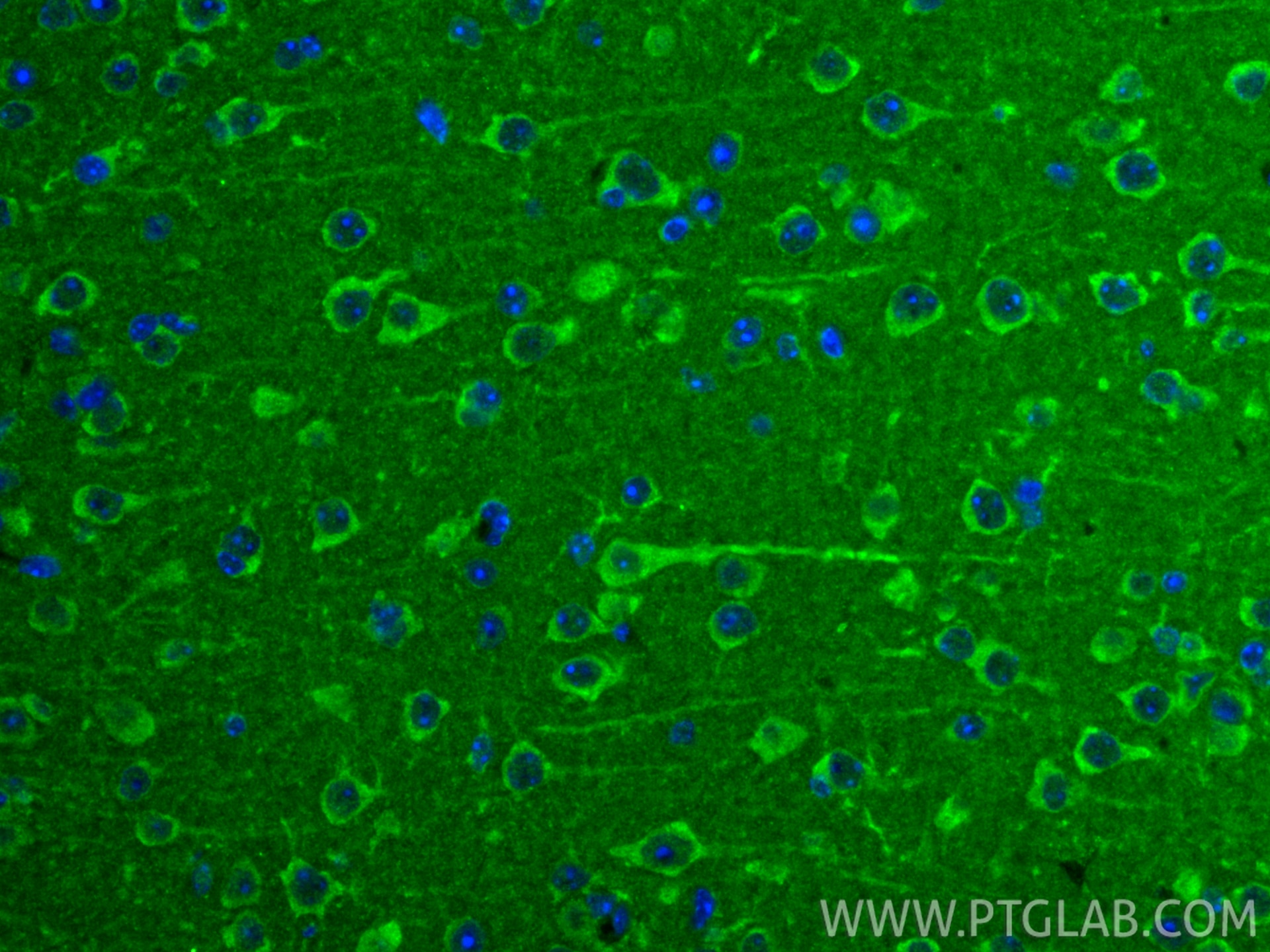 IF Staining of mouse brain using 31917-1-AP (same clone as 31917-1-PBS) Immunofluorescence (IF) / fluorescent staining of mouse brain tissue using TMEM143 Polyclonal antibody (31917-1-AP)