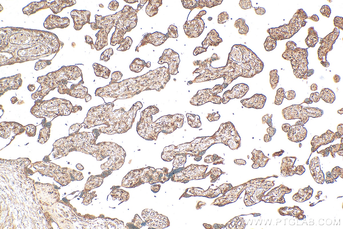 Immunohistochemistry (IHC) staining of human placenta tissue using TMEM143 Polyclonal antibody (31917-1-AP)