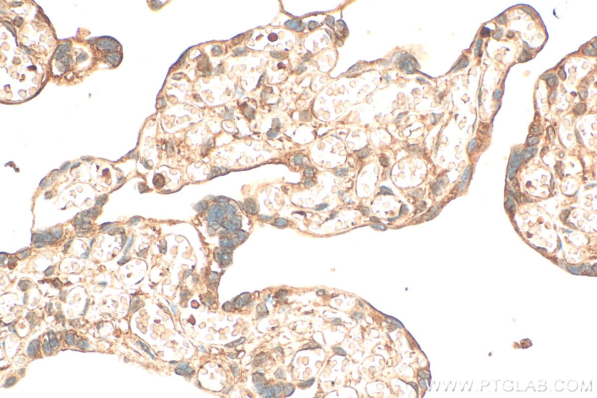 Immunohistochemistry (IHC) staining of human placenta tissue using TMEM143 Polyclonal antibody (31917-1-AP)