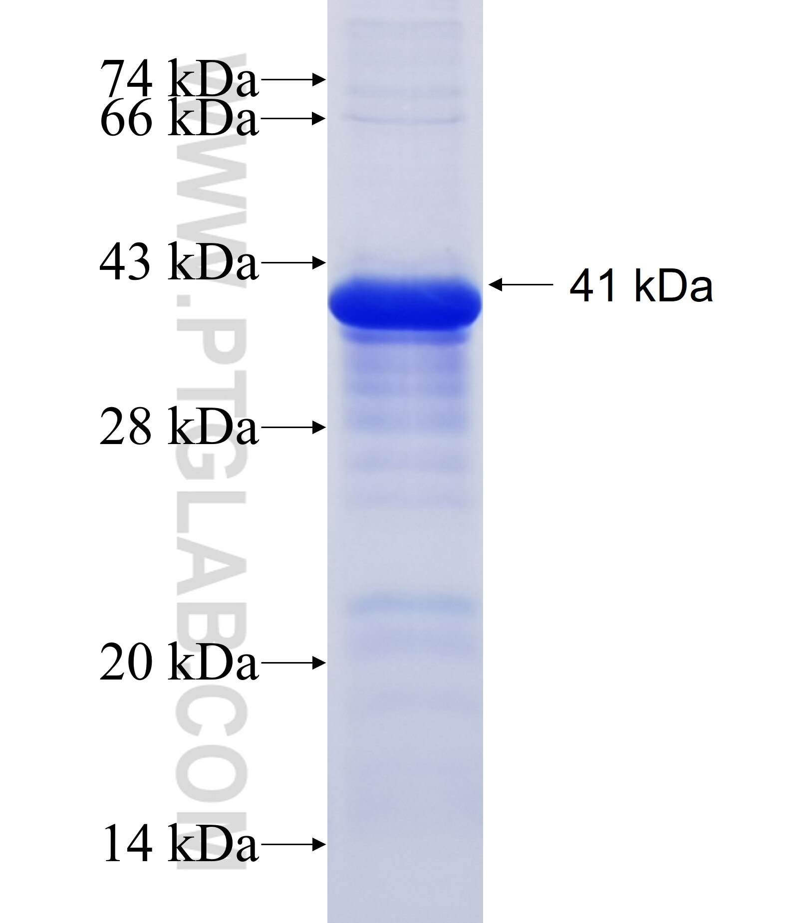 TMEM149 fusion protein Ag22617 SDS-PAGE
