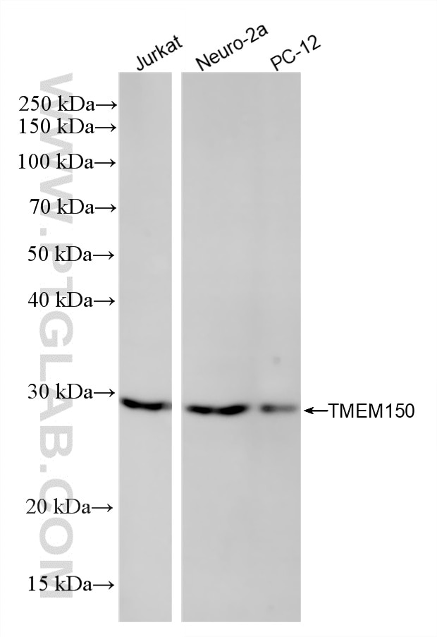 Western Blot (WB) analysis of various lysates using TMEM150 Recombinant monoclonal antibody (87578-1-RR)