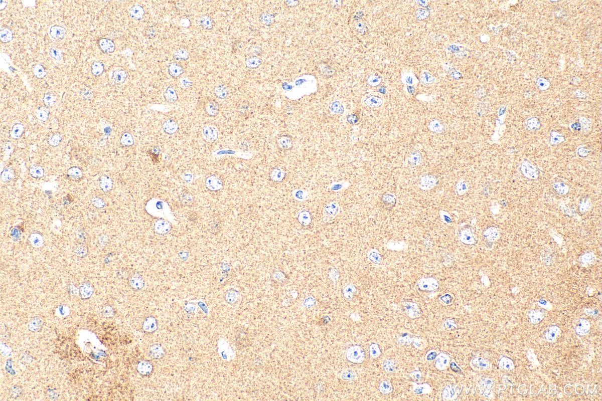 Immunohistochemistry (IHC) staining of mouse brain tissue using TMEM151A Polyclonal antibody (31640-1-AP)