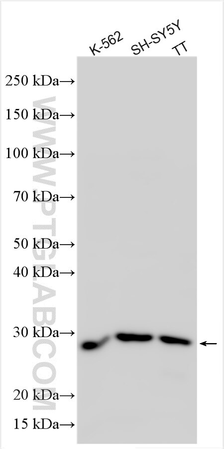 Western Blot (WB) analysis of various lysates using TMEM151B Polyclonal antibody (31682-1-AP)