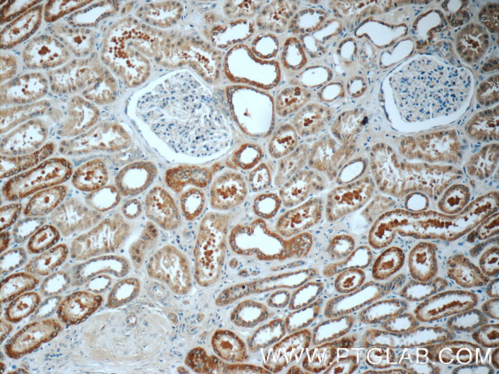 Immunohistochemistry (IHC) staining of human kidney tissue using TMEM154 Polyclonal antibody (24812-1-AP)