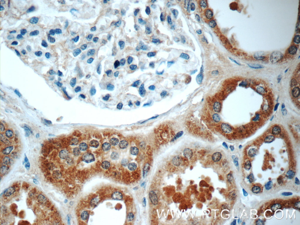 Immunohistochemistry (IHC) staining of human kidney tissue using TMEM154 Polyclonal antibody (24812-1-AP)