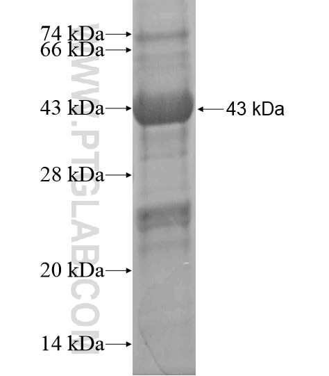 TMEM154 fusion protein Ag20054 SDS-PAGE