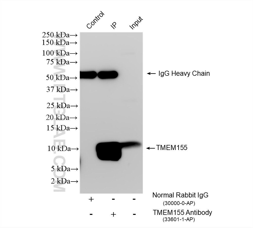 Immunoprecipitation (IP) experiment of mouse brain tissue using TMEM155 Polyclonal antibody (33601-1-AP)