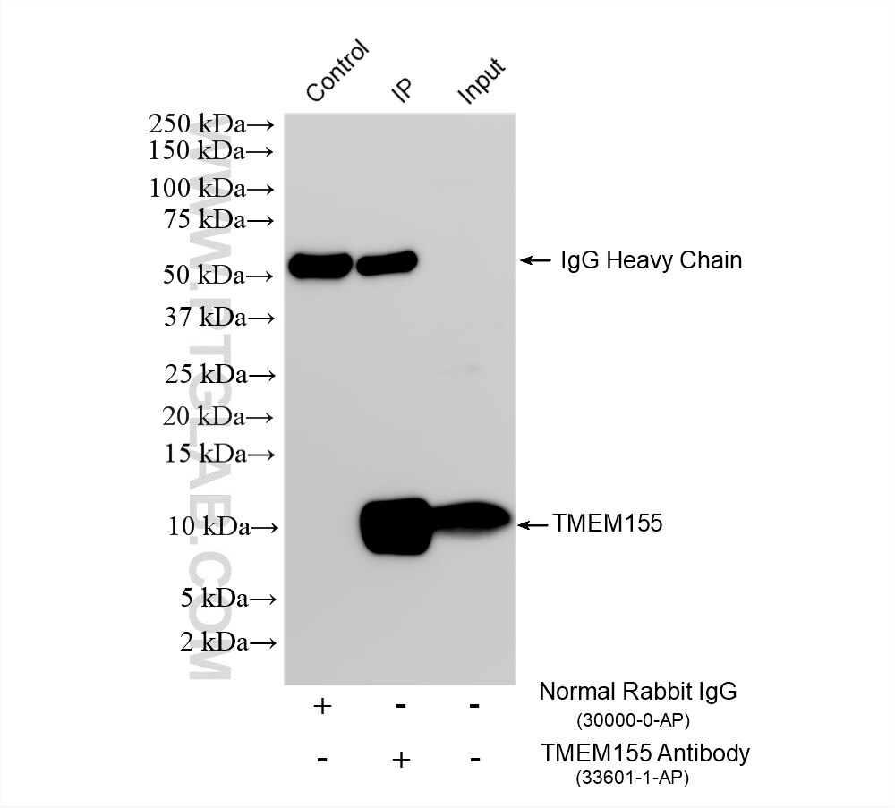Immunoprecipitation (IP) experiment of pig brain tissue using TMEM155 Polyclonal antibody (33601-1-AP)