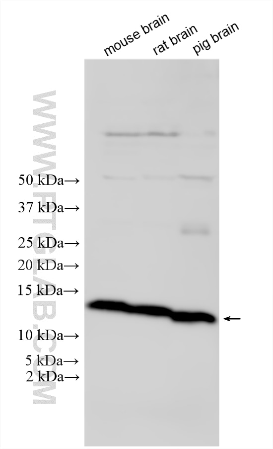 Western Blot (WB) analysis of various lysates using TMEM155 Polyclonal antibody (33601-1-AP)