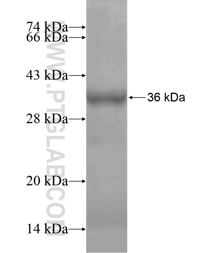 TMEM156 fusion protein Ag18336 SDS-PAGE