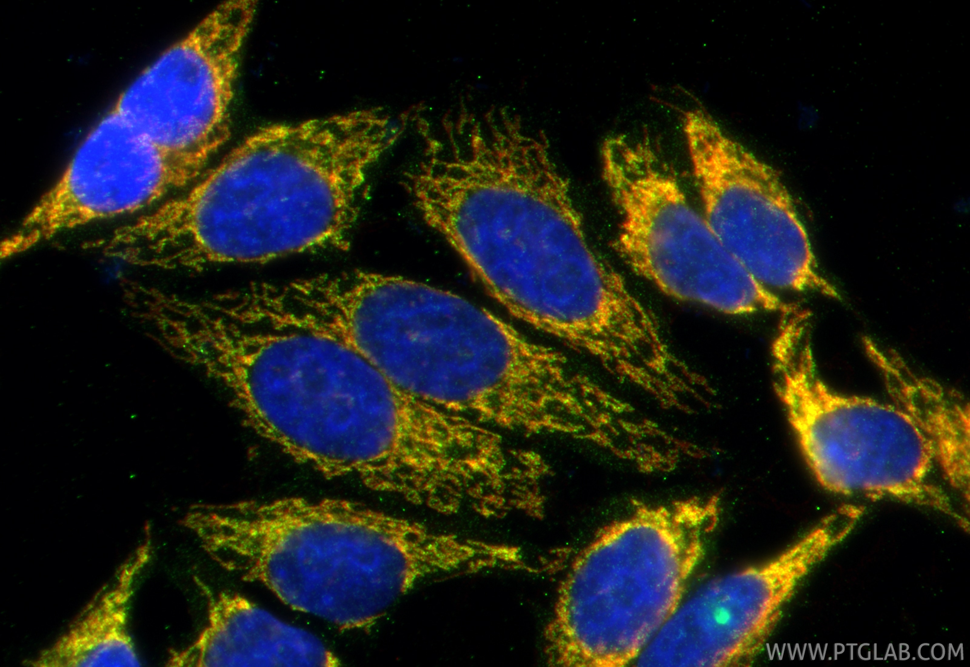 Immunofluorescence (IF) / fluorescent staining of HepG2 cells using TMEM160 Polyclonal antibody (26451-1-AP)