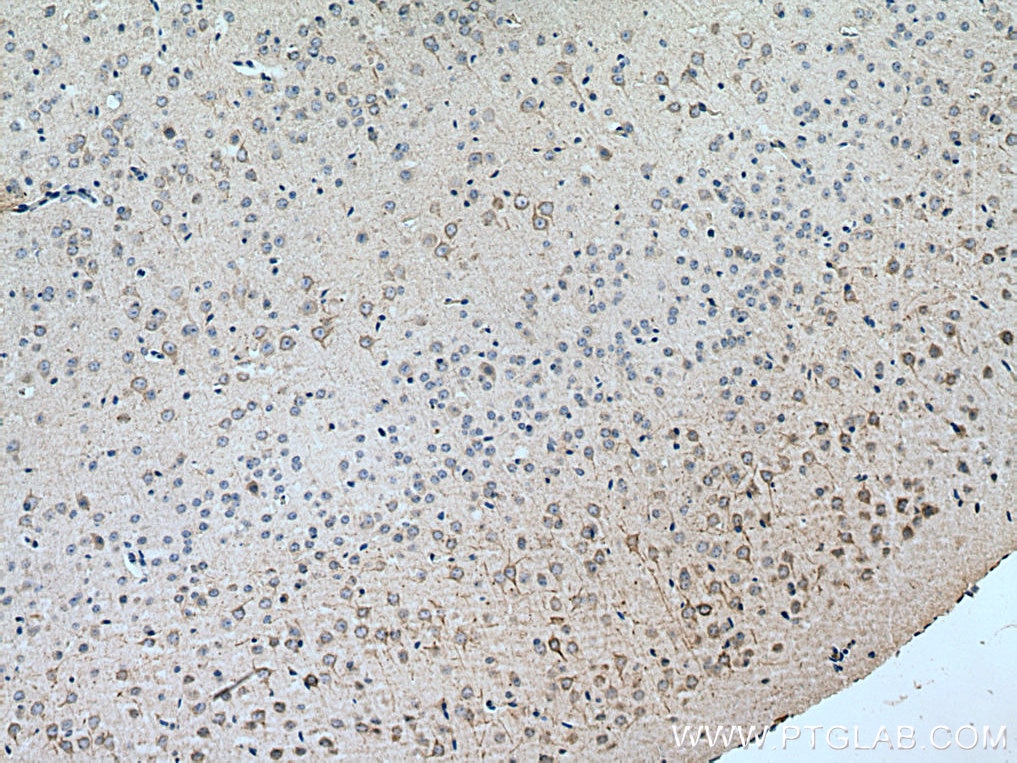 Immunohistochemistry (IHC) staining of mouse brain tissue using TMEM161A Polyclonal antibody (24898-1-AP)