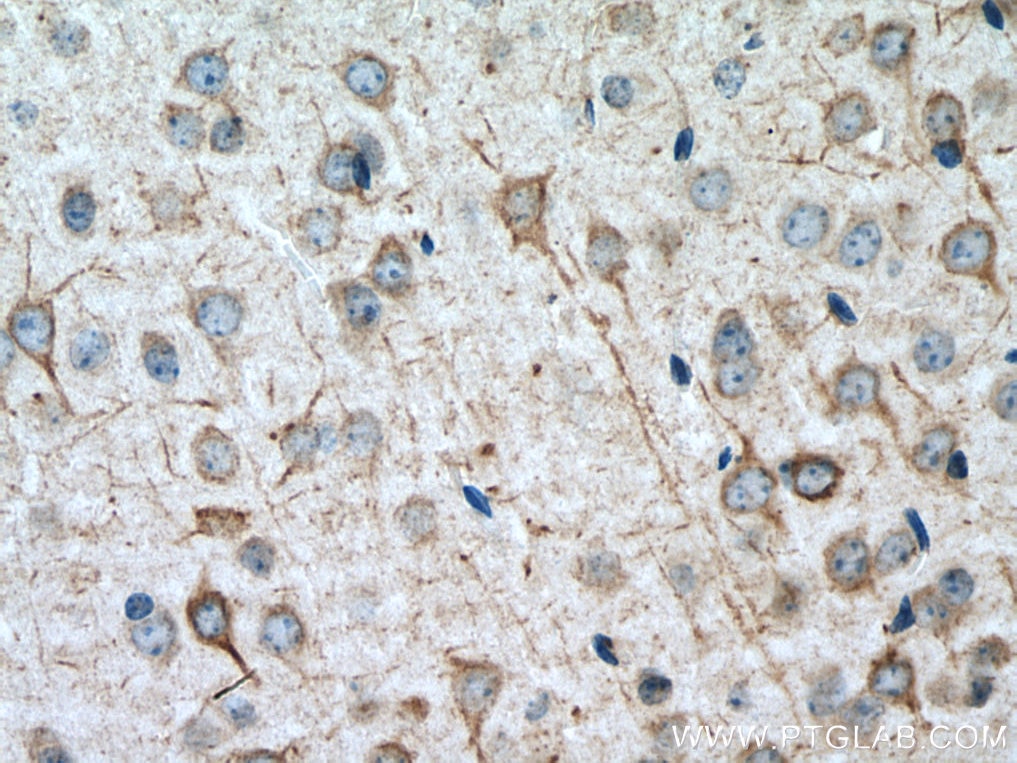 Immunohistochemistry (IHC) staining of mouse brain tissue using TMEM161A Polyclonal antibody (24898-1-AP)