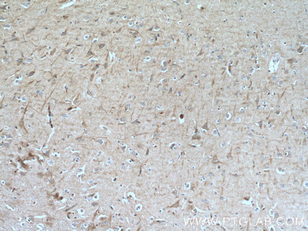 Immunohistochemistry (IHC) staining of human brain tissue using TMEM161A Polyclonal antibody (24898-1-AP)