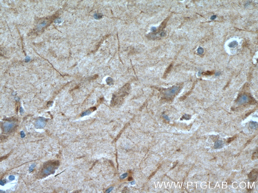 Immunohistochemistry (IHC) staining of human brain tissue using TMEM161A Polyclonal antibody (24898-1-AP)