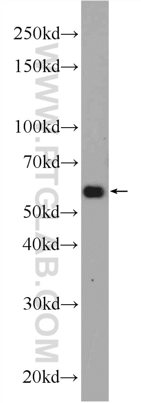 Western Blot (WB) analysis of HEK-293 cells using TMEM161A Polyclonal antibody (24898-1-AP)