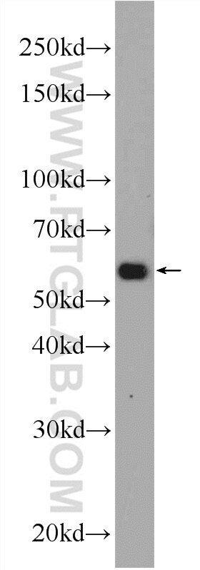 Western Blot (WB) analysis of HEK-293 cells using TMEM161A Polyclonal antibody (24898-1-AP)