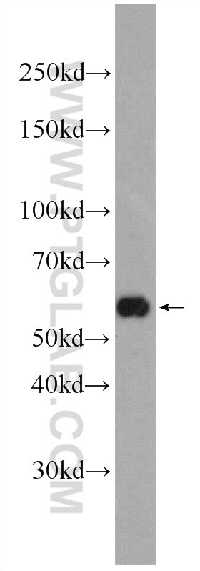 Western Blot (WB) analysis of HT-1080 cells using TMEM161A Polyclonal antibody (24898-1-AP)
