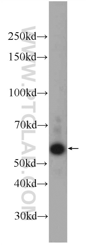 Western Blot (WB) analysis of MCF-7 cells using TMEM161A Polyclonal antibody (24898-1-AP)