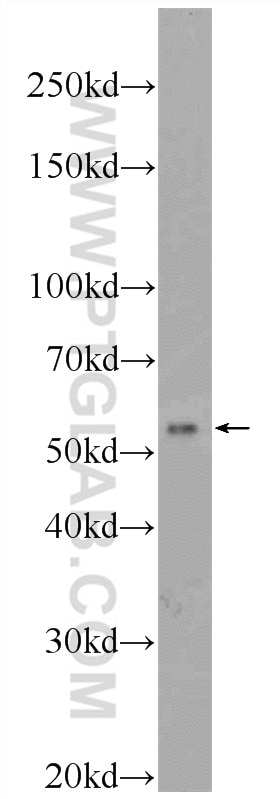 Western Blot (WB) analysis of PC-3 cells using TMEM161A Polyclonal antibody (24898-1-AP)