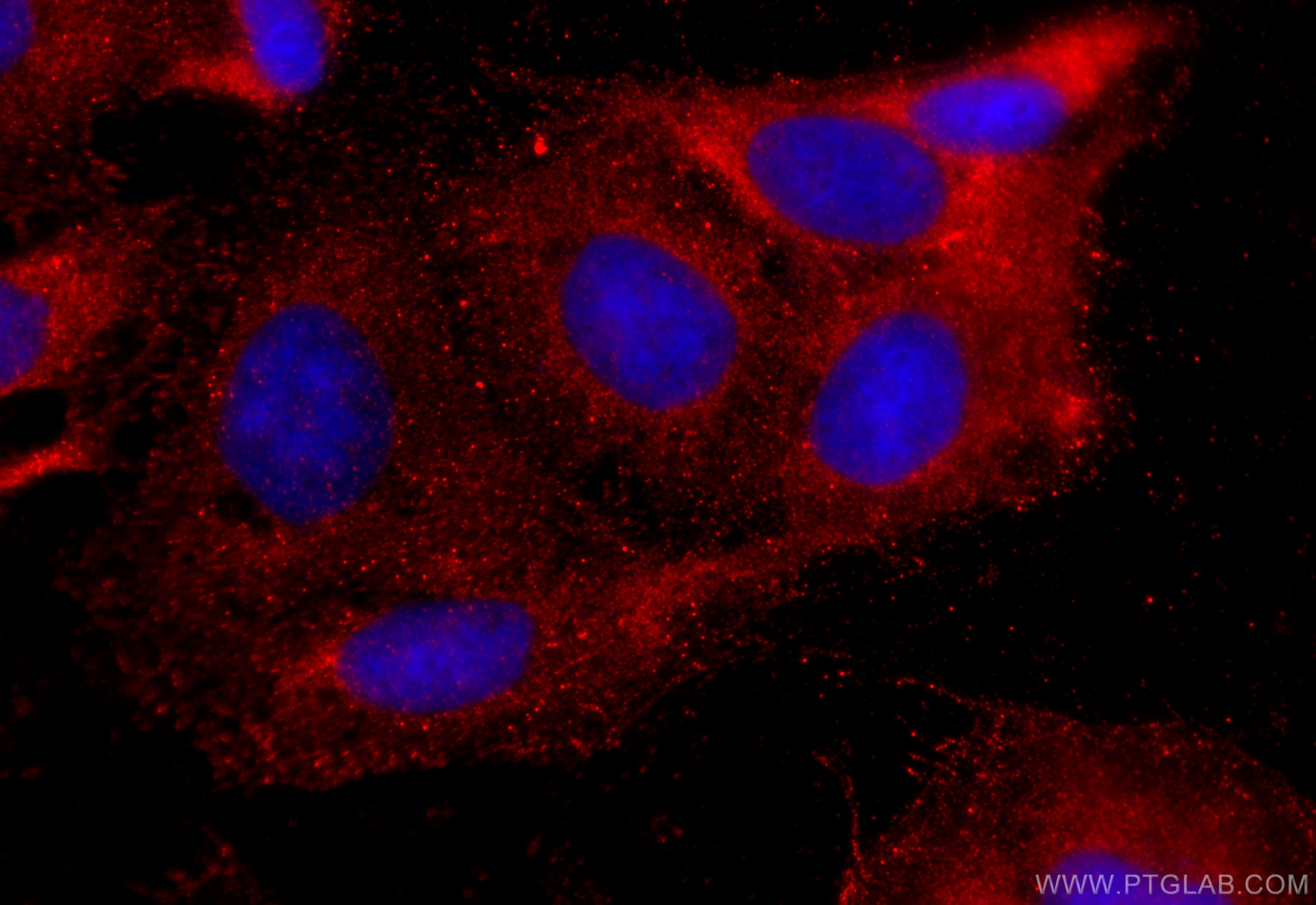 IF Staining of U2OS using 31625-1-AP (same clone as 31625-1-PBS) Immunofluorescence (IF) / fluorescent staining of U2OS cells using TMEM164 Polyclonal antibody (31625-1-AP)