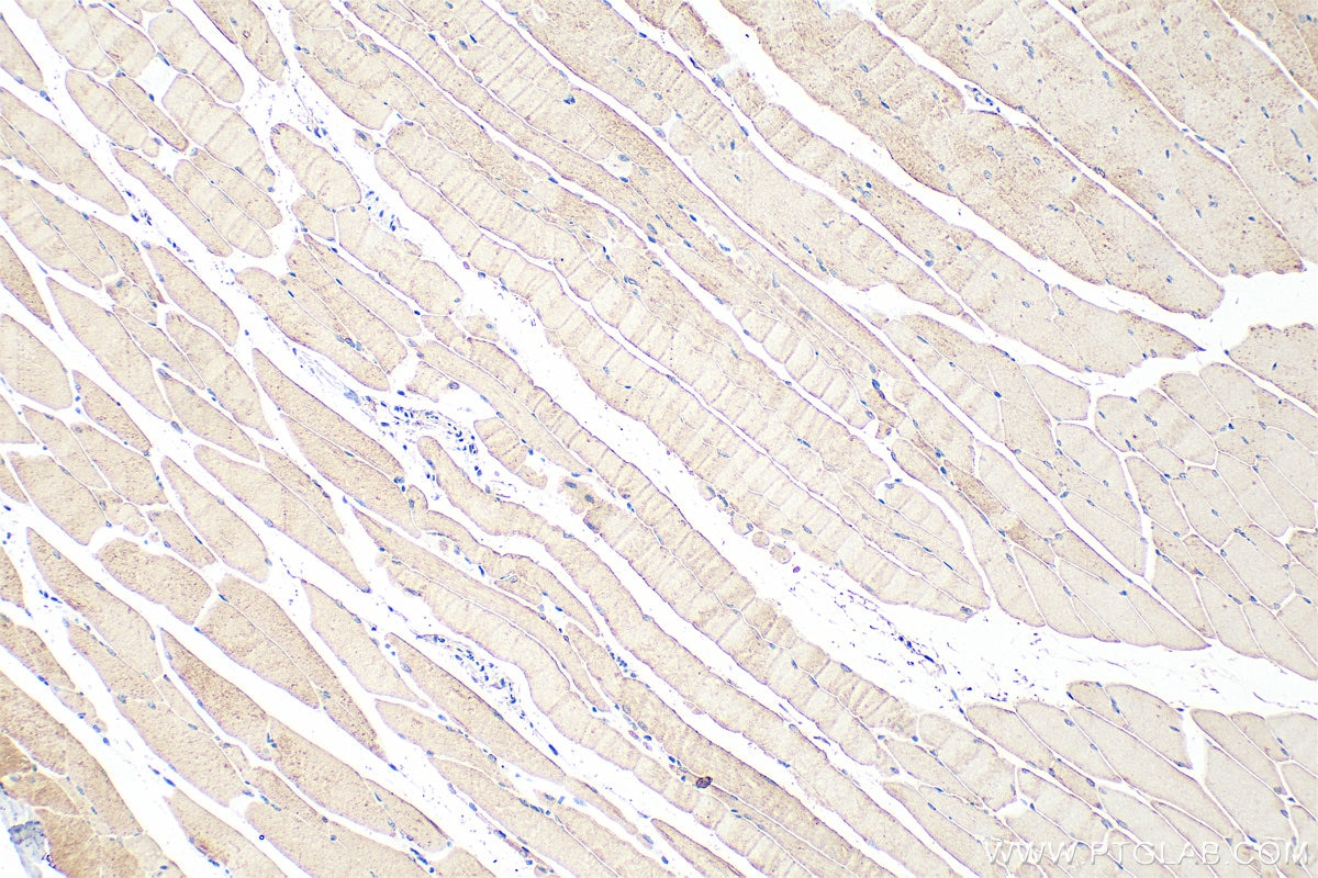 IHC staining of mouse skeletal muscle using 31625-1-AP (same clone as 31625-1-PBS) Immunohistochemistry (IHC) staining of mouse skeletal muscle tissue using TMEM164 Polyclonal antibody (31625-1-AP)
