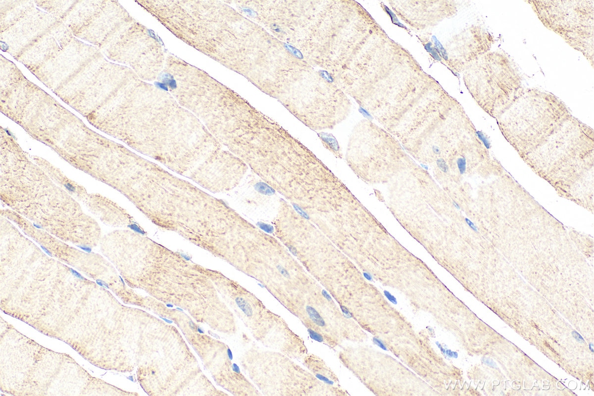 IHC staining of mouse skeletal muscle using 31625-1-AP (same clone as 31625-1-PBS) Immunohistochemistry (IHC) staining of mouse skeletal muscle tissue using TMEM164 Polyclonal antibody (31625-1-AP)
