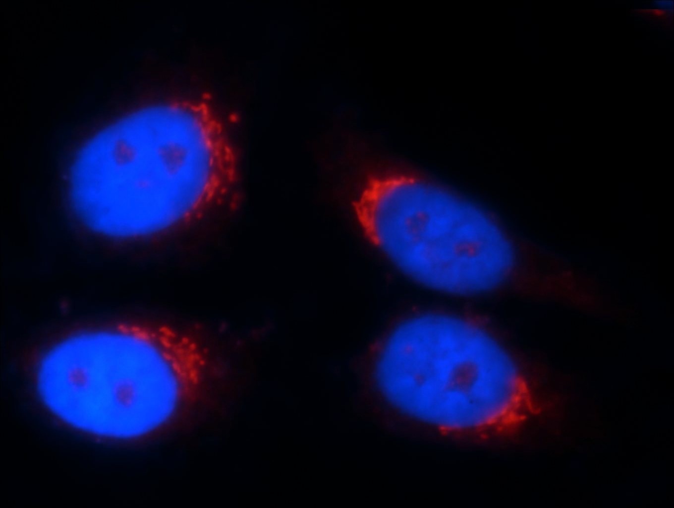 Immunofluorescence (IF) / fluorescent staining of HepG2 cells using TMEM165 Polyclonal antibody (20485-1-AP)