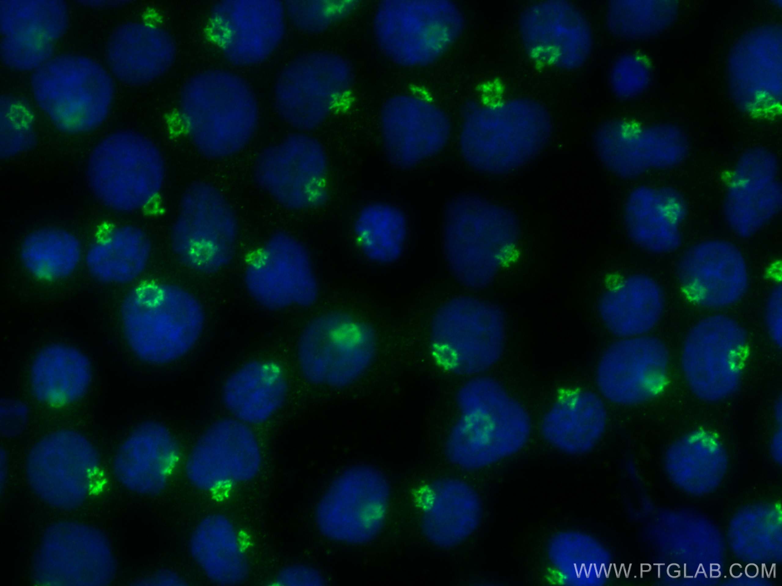 Immunofluorescence (IF) / fluorescent staining of Jurkat cells using TMEM165 Polyclonal antibody (20485-1-AP)