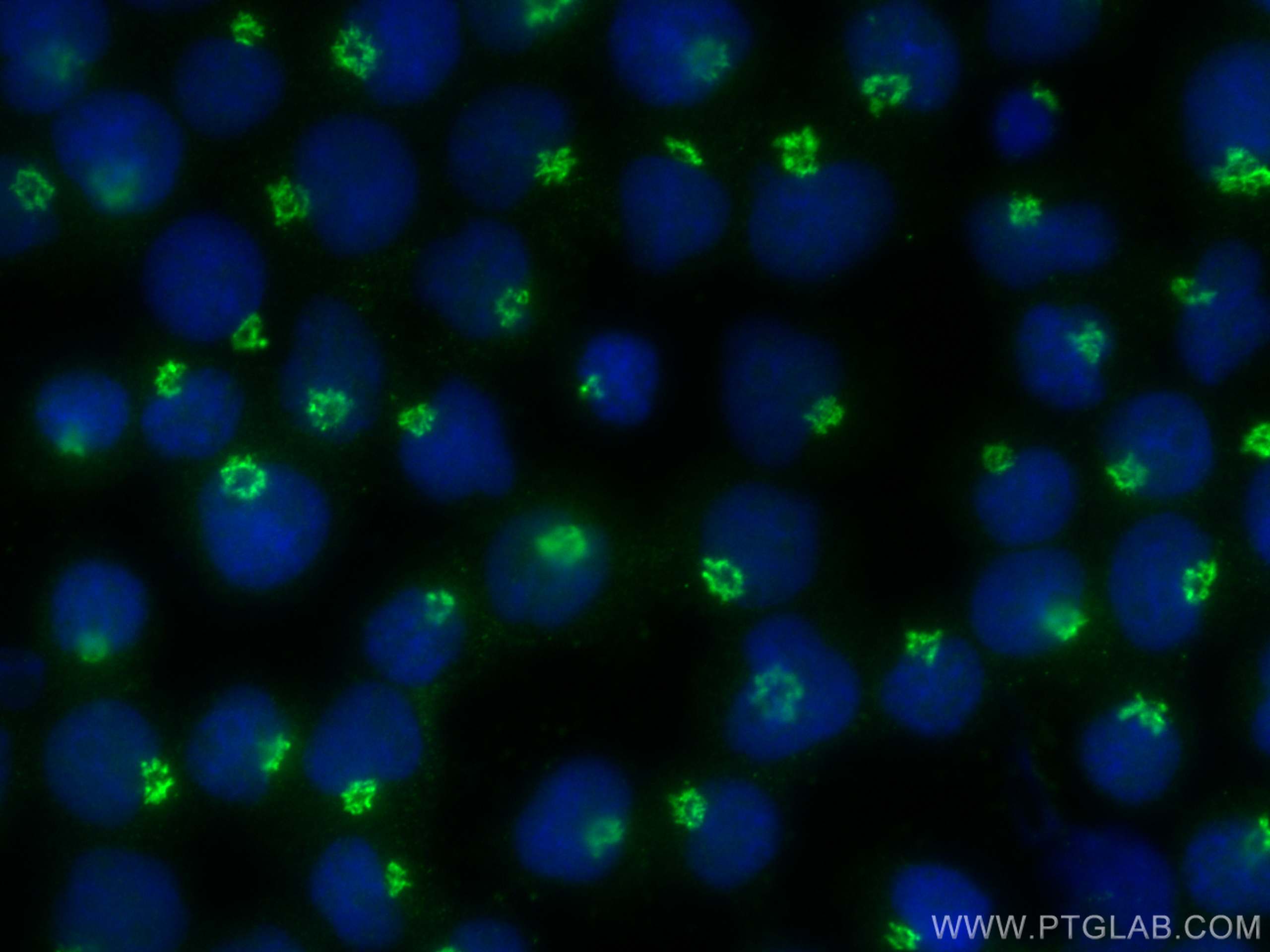 Immunofluorescence (IF) / fluorescent staining of Jurkat cells using TMEM165 Polyclonal antibody (20485-1-AP)
